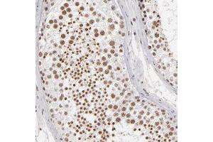 Immunohistochemical staining of human testis with INTS6 polyclonal antibody  shows cytoplasmic positivity in trophoblastic cells at 1:50-1:200 dilution.