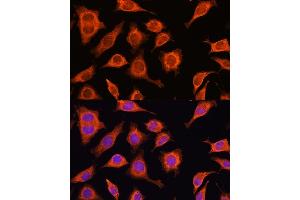 Immunofluorescence analysis of L929 cells using D Rabbit pAb (ABIN6127743, ABIN6139383, ABIN6139384 and ABIN6223348) at dilution of 1:100. (DAAM2 Antikörper  (AA 1-86))