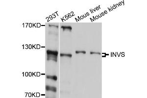 Western blot analysis of extracts of various cell lines, using INVS antibody (ABIN5997996) at 1/1000 dilution. (Inversin Antikörper)