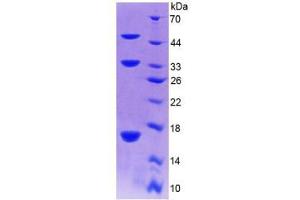 SDS-PAGE analysis of Mouse Collagen Type X Protein.