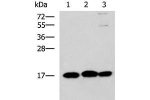 Western blot analysis of 231 HL60 and Jurkat cell lysates using RPS14 Polyclonal Antibody at dilution of 1:700 (RPS14 Antikörper)