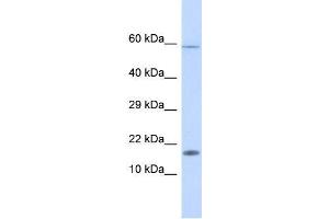 Human Fetal liver; WB Suggested Anti-HERC4 Antibody. (HERC4 Antikörper  (Isoform 5, Middle Region))