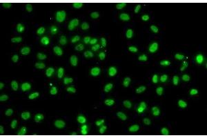 Immunofluorescence analysis of A-549 cells using PMS2 Polyclonal Antibody (PMS2 Antikörper)