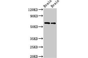 Western Blot Positive WB detected in: Rat brain tissue, Mouse brain tissue All lanes: CPNE4 antibody at 2 μg/mL Secondary Goat polyclonal to rabbit IgG at 1/50000 dilution Predicted band size: 63, 65 kDa Observed band size: 63 kDa (Copine IV Antikörper  (AA 1-280))