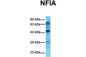 Host:  Rabbit  Target Name:  NFIA  Sample Tissue:  Human Fetal Lung  Antibody Dilution:  1. (NFIA Antikörper  (Middle Region))