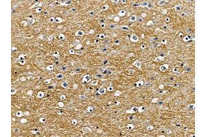 ABIN6257490 and ABIN6275517 at 1/100 staining mouse brain tissue by IHC-P. (SCAMP1 Antikörper  (N-Term))