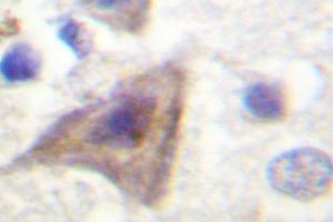Image no. 1 for anti-AKT1 Substrate 1 (Proline-Rich) (AKT1S1) antibody (ABIN271990) (PRAS40 Antikörper)