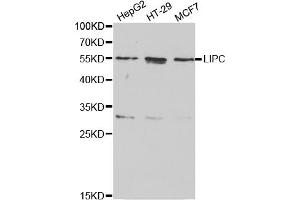 Western blot analysis of extracts of various cell lines, using LIPC antibody (ABIN5970666) at 1/1000 dilution. (LIPC Antikörper)