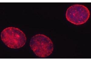 IF analysis of SHQ1 using anti-SHQ1 antibody (ABIN7599205). (SHQ1 Antikörper  (AA 1-277))