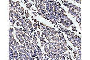 IHC analysis of EDC4 using anti-EDC4 antibody (ABIN7599694). (EDC4 Antikörper  (AA 1082-1388))