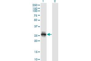 Western Blot analysis of KLK4 expression in transfected 293T cell line by KLK4 monoclonal antibody (M09), clone 2A4. (Kallikrein 4 Antikörper  (AA 159-254))