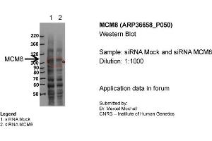 MCM8 WB Sample: siRNA Mock and siRNA MCM8 Dilution 1:1000 (MCM8 Antikörper  (N-Term))