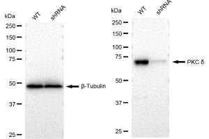 Western blotting analysis using PKC delta antibody (ABIN7799993).