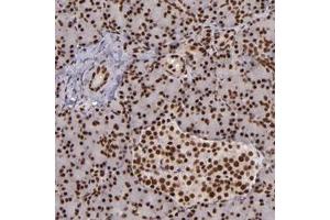 Immunohistochemical staining of human pancreas with PQBP1 polyclonal antibody  shows strong nuclear positivity in exocrine glandular cells and islet cells. (PQBP1 Antikörper)