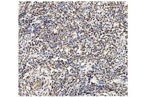 anti-6-phosphofructo-2-Kinase/fructose-2,6-Biphosphatase 2 (PFKFB2) (AA 4-505) antibody