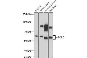 Western blot analysis of extracts of various cell lines, using RORC antibody (ABIN6132603, ABIN6147079, ABIN6147080 and ABIN6214413) at 1:1000 dilution. (RORC Antikörper  (AA 120-320))