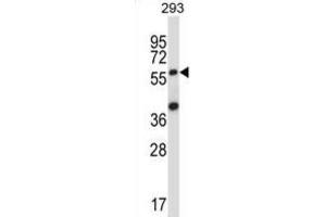 Western Blotting (WB) image for anti-Suppressor of Cytokine Signaling 6 (SOCS6) antibody (ABIN2997743) (SOCS6 Antikörper)