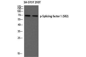 Western Blot (WB) analysis of SH-SY5Y 293T using p-Splicing factor 1 (S82) antibody. (Splicing Factor 1 Antikörper  (pSer82))
