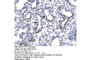 Rabbit Anti-HEY1 Antibody  Paraffin Embedded Tissue: Human Lung Cellular Data: Alveolar cells Antibody Concentration: 4.