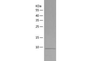 Western Blotting (WB) image for ATP-Binding Cassette, Sub-Family B (MDR/TAP), Member 5 (ABCB5) (AA 141-247) protein (His tag) (ABIN7287413) (ABCB5 Protein (AA 141-247) (His tag))