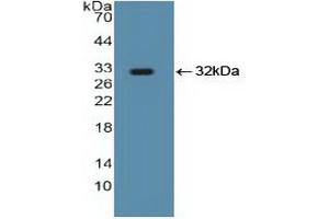 Western blot analysis of recombinant Human Smad5.