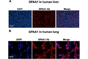 Immunofluorescent staining of human liver (A) and human lung (B) with GPAA1 polyclonal antibody  at 1:100 dilution. (GPAA1 Antikörper  (C-Term))
