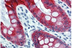 Colon, Human: Formalin-Fixed, Paraffin-Embedded (FFPE) (Cytokeratin 18 Antikörper)