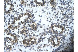 Immunohistochemistry (IHC) image for anti-Hematopoietically Expressed Homeobox (HHEX) (Middle Region) antibody (ABIN2777302)