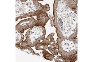 Immunohistochemical staining of human placenta with KIAA1009 polyclonal antibody  shows strong membranous and nuclear positivity in trophoblastic cells.