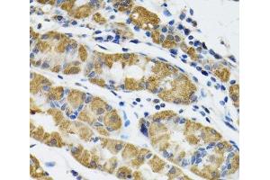 Immunohistochemistry (Paraffin-embedded Sections) (IHC (p)) image for anti-Hyaluronan and Proteoglycan Link Protein 1 (HAPLN1) antibody (ABIN7262493)