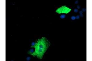 Anti-ZFP36 mouse monoclonal antibody (ABIN2454209) immunofluorescent staining of COS7 cells transiently transfected by pCMV6-ENTRY ZFP36 (RC202049). (ZFP36 Antikörper)