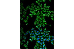 Immunofluorescence analysis of HeLa cells using ANGPT2 antibody. (Angiopoietin 2 Antikörper  (AA 197-496))