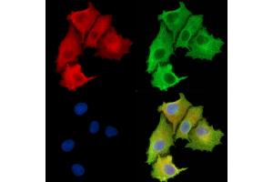 ABIN6263526 and ABIN6279596 staining  cells by IF/ICC. (NBPF3 Antikörper  (Internal Region))