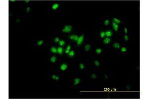 Immunofluorescence of monoclonal antibody to TFAP4 on HeLa cell. (TFAP4 Antikörper  (AA 93-192))