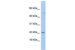 Image no. 1 for anti-Chromosome 19 Open Reading Frame 25 (C19orf25) (N-Term) antibody (ABIN6742475) (C19orf25 Antikörper  (N-Term))