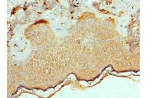Immunohistochemistry of paraffin-embedded human skin tissue using ABIN7172544 at dilution of 1:100 (ETV6 Antikörper  (AA 1-300))