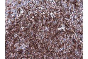 Immunohistochemistry (IHC) image for anti-T-cell surface glycoprotein CD1c (CD1C) antibody (ABIN2670667) (CD1c Antikörper)