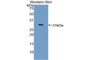 Western blot analysis of the recombinant protein. (ASK1 Antikörper  (AA 693-933))