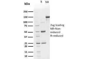 SDS-PAGE Analysis Purified CHP2 Mouse Monoclonal Antibody (CPTC-CHP2-1). (Chp2 Antikörper)