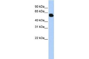 FTCD antibody used at 1 ug/ml to detect target protein. (FTCD Antikörper  (Middle Region))