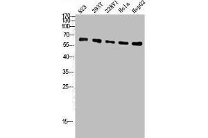 Western Blot analysis of 823 293T 22RV1 Hela HepG2 cells using ATP5A Polyclonal Antibody (ATP5A1 Antikörper  (Internal Region))