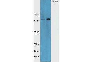 Lane 1: mouse brain lysate Lane 2: Raji cell lysate probed with Rabbit Anti-HRG beta 1 Polyclonal Antibody, Unconjugated (ABIN716051) at 1:300 overnight at 4 °C. (Hrg beta 1 (AA 65-150) Antikörper)