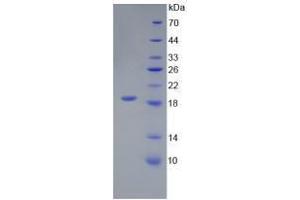 Image no. 1 for Interleukin 18 (IL18) (AA 36-192) (Active) protein (His tag) (ABIN6239812) (IL-18 Protein (AA 36-192) (His tag))