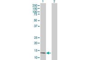 Western Blotting (WB) image for SLURP1 293T Cell Transient Overexpression Lysate(Denatured) (ABIN1337192)