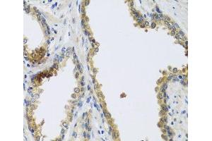Immunohistochemistry of paraffin-embedded Human prostate using GFER Polyclonal Antibody at dilution of 1:100 (40x lens). (GFER Antikörper)