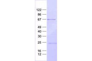 Western Blotting (WB) image for Suppressor of Cytokine Signaling 5 (SOCS5) protein (His tag) (ABIN2732345)