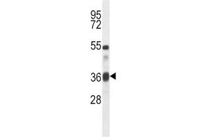 Western Blotting (WB) image for anti-Transforming Growth Factor, beta 1 (TGFB1) antibody (ABIN5016291) (TGFB1 Antikörper)
