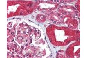 Immunohistochemistry (IHC) image for anti-ATP-Binding Cassette, Sub-Family B (MDR/TAP), Member 1 (ABCB1) (AA 262-277) antibody (ABIN2469658)