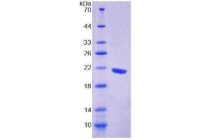 SDS-PAGE analysis of Human GFM1 Protein.
