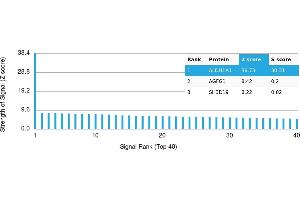 Protein Array (PAr) image for anti-Aldehyde Dehydrogenase 1 Family, Member A1 (ALDH1A1) antibody (ABIN7456058) (ALDH1A1 Antikörper)